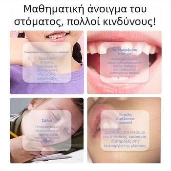 Εκγύμναση μυών χειλιών για διόρθωση της στοματικής αναπνοής – συσκευή κατά του ροχαλητού, έκδοση για ενήλικες, Υλικό PP, αδενοειδής υπερτροφία