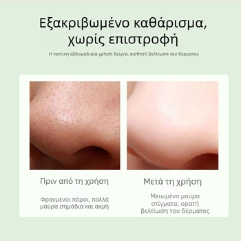 Συσκευή κενού για απομάκρυνση μαύρων στιγμάτων προσώπου, μοντέλο DYM028, Define Beauty, ορατά αφαιρεί μαύρα στίγματα και ακμή, 3 ρυθμίσεις ισχύος