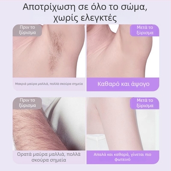 Ηλεκτρική ξυριστική μηχανή και απομάκρυνση τρίχων TMQ-623 με κεφαλή διαμαντιού, επαναφορτιζόμενη μέσω USB, υγρή/στεγνή χρήση για όλο το σώμα