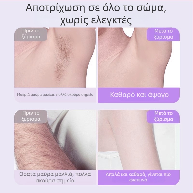 Ηλεκτρική ξυριστική μηχανή και απομάκρυνση τρίχων TMQ-623 με κεφαλή διαμαντιού, επαναφορτιζόμενη μέσω USB, υγρή/στεγνή χρήση για όλο το σώμα