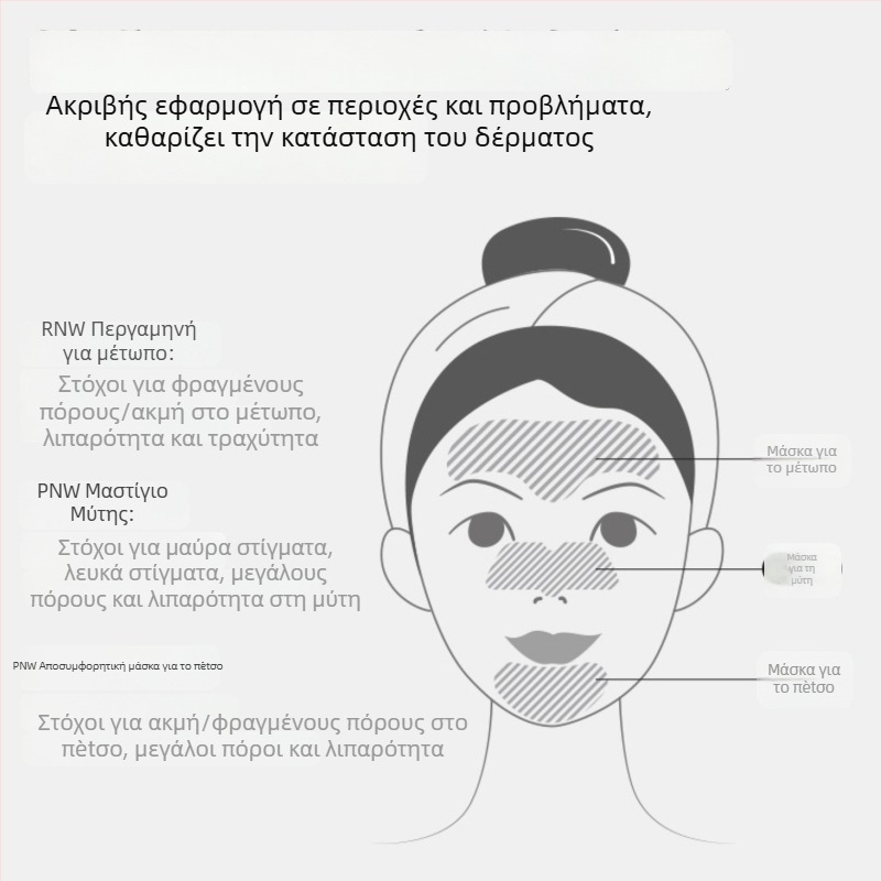 RNW αυτοκόλλητο μύτης για αφαίρεση μαύρων στίγματων – Φροντίδα Τ-ζώνης, 10 αυτοκόλλητα, αφαιρεί μαύρα στίγματα, καταπραΰνει και μαλακώνει το δέρμα, κατάλληλο για κανονικό, λιπαρό, ξηρό και μεικτό δέρμα