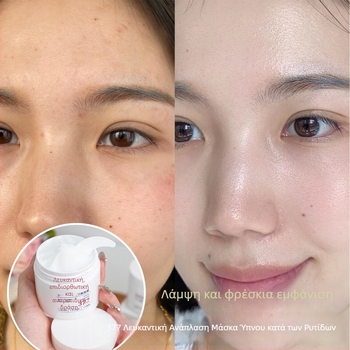Μάσκα ύπνου λεύκανσης και επανόρθωσης κατά των ρυτίδων (κρέμα-gel) — έλεγχος λιπαρότητας, αφαίρεση μαύρων στιγμάτων, ενυδάτωση, σύσφιξη, καταπράυνση δέρματος