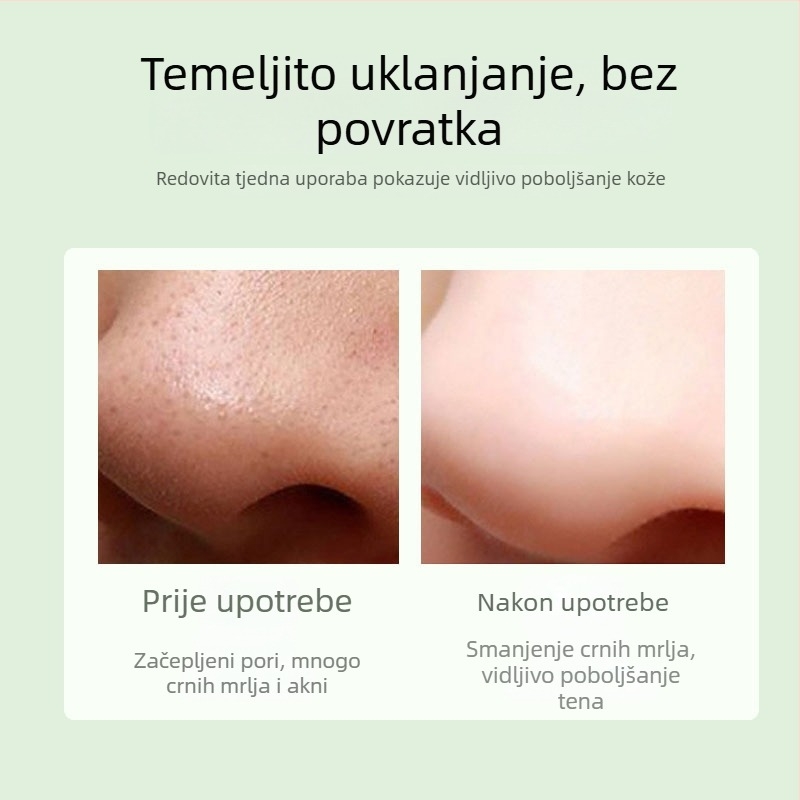 Vakuumski uređaj za čišćenje lica za uklanjanje crnih točkica, model DYM028, Define Beauty, vidljivo uklanja crne točkice i akne, 3 razine podešavanja