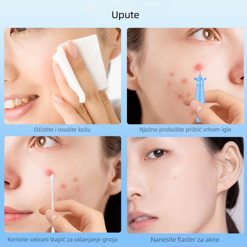 Igla za ekstrakciju prištića, jednokratna upotreba, nehrđajući čelik, šifra proizvoda z7NAR7rA, marka Druga