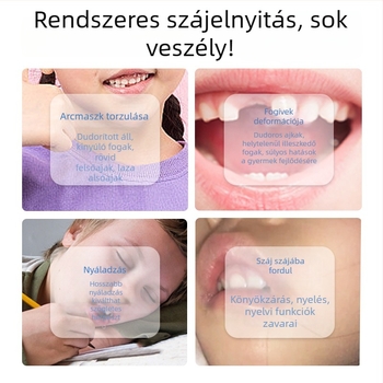 Ajakizmok edzője a szájüregen át történő légzés korrekciójához – Horkolás elleni készülék, felnőtt kiadás, PP anyag, testreszabás nélkül, adenoid hipertrófia kontextusban
