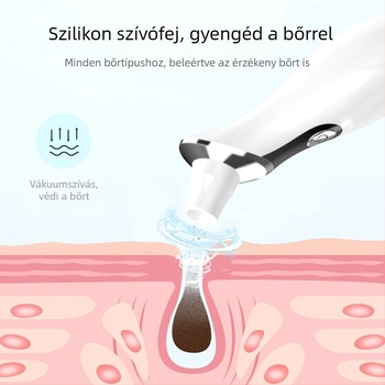 Vákuumos arctisztító készülék mitesszerek eltávolítására, modell DYM028, Define Beauty, láthatóan felszívja a mitesszereket és a pattanásokat, 3 fokozat