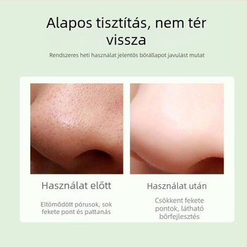 Vákuumos arctisztító készülék mitesszerek eltávolítására, modell DYM028, Define Beauty, láthatóan felszívja a mitesszereket és a pattanásokat, 3 fokozat