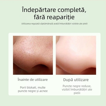 Instrument de curățare facială cu vid pentru eliminarea punctelor negre, model DYM028, Define Beauty, vizibil elimină punctele negre și acneea, 3 niveluri de putere